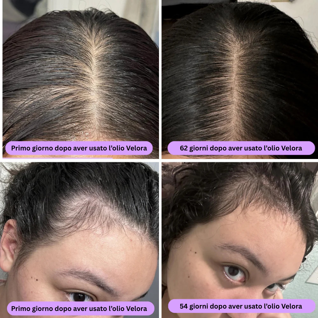 ™ - olio naturale per la crescita dei capelli