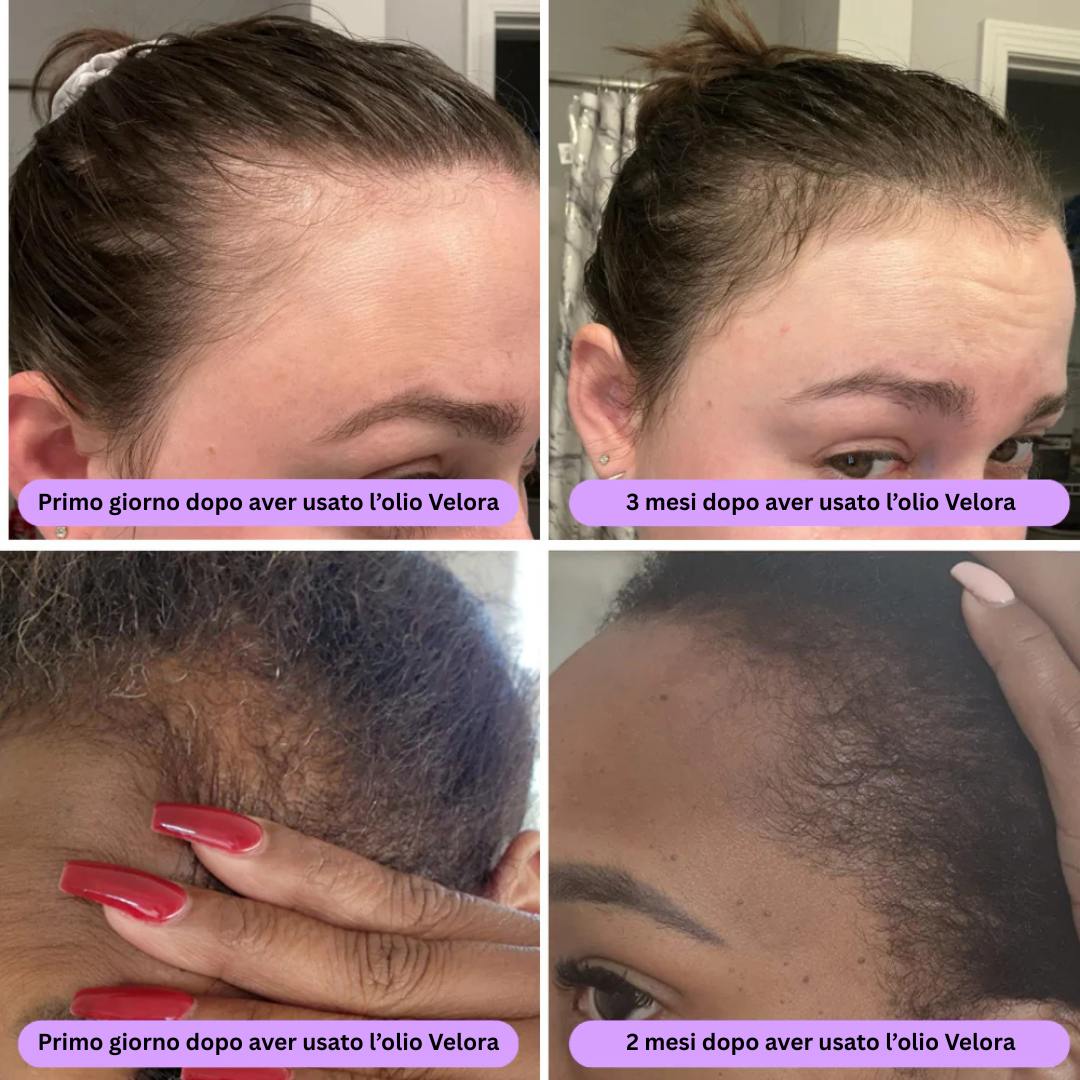 ™ - olio naturale per la crescita dei capelli